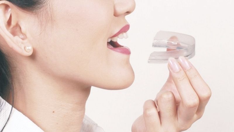 Miếng chống nghiến răng là gì? Nghiến răng có cần khám nha khoa tổng quát?