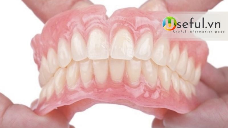 Chỉnh khớp cắn chuẩn để niềng răng có được không?