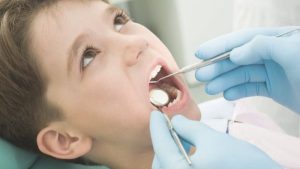 Răng hàm có thay không? Bao lâu nên khám nha khoa trẻ em một lần