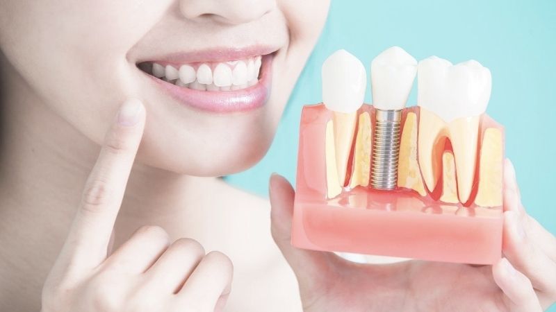 Giải đáp thắc mắc trồng răng implant có đau không?