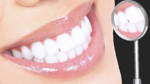 Bảng giá tẩy trắng răng nha khoa có đắt hay không?