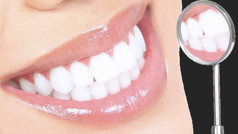 Bảng giá tẩy trắng răng nha khoa có đắt hay không?