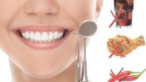 Nhổ răng nên kiêng ăn gì? Các loại thực phẩm nên kiêng sau khi nhổ răng