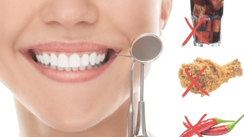 Nhổ răng nên kiêng ăn gì? Các loại thực phẩm nên kiêng sau khi nhổ răng