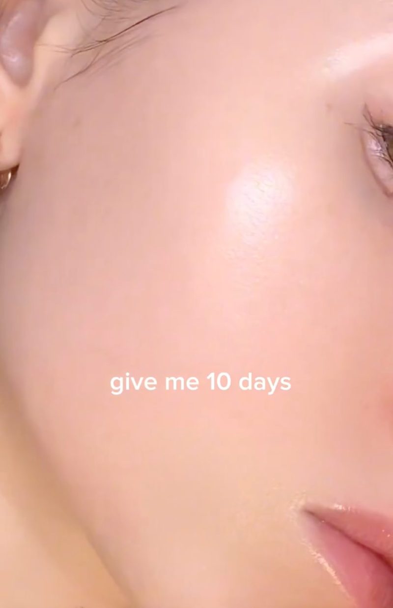 Mỹ phẩm vi kim (spicules): Trò chơi Mỹ phẩm vi kim (spicules): Trò chơi