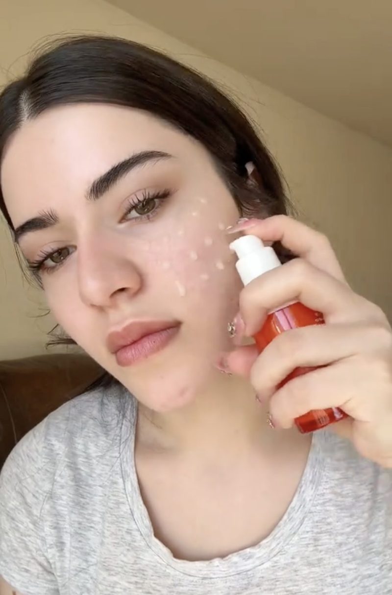 Mỹ phẩm vi kim (spicules): Trò chơi Mỹ phẩm vi kim (spicules): Trò chơi