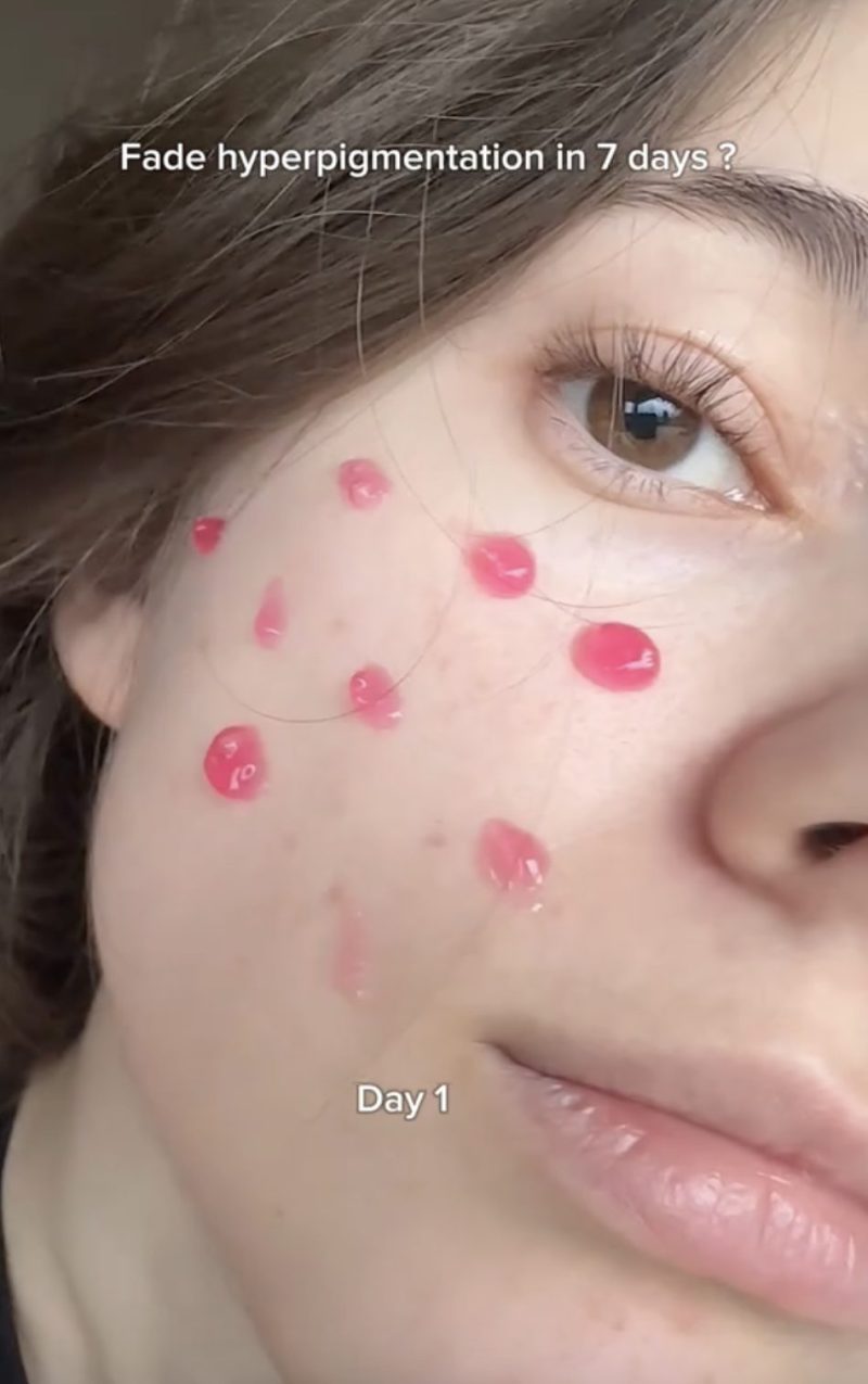 Mỹ phẩm vi kim (spicules): Trò chơi Mỹ phẩm vi kim (spicules): Trò chơi