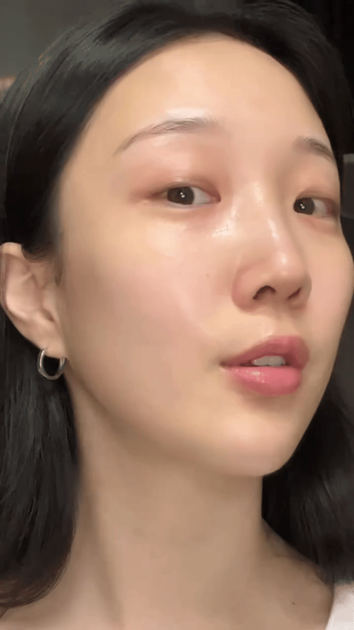 Mỹ phẩm vi kim (spicules): Trò chơi Mỹ phẩm vi kim (spicules): Trò chơi