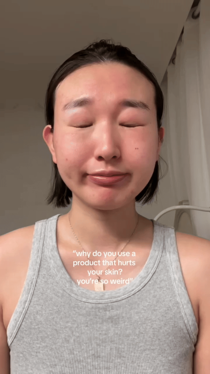 Mỹ phẩm vi kim (spicules): Trò chơi Mỹ phẩm vi kim (spicules): Trò chơi