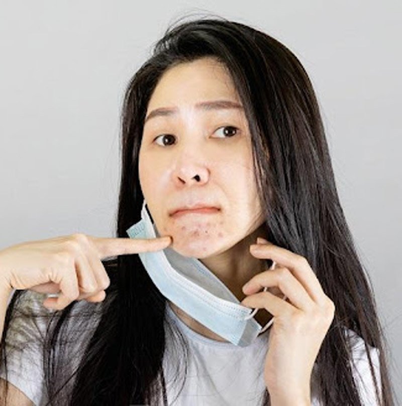 Các loại sữa rửa mặt có độ pH cao (trên 7) có thể phá vỡ lớp màng bảo vệ tự nhiên của da