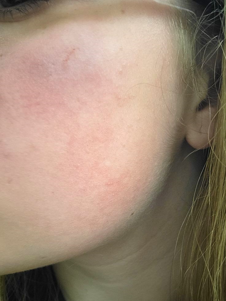 3 món tủ giúp tôi hồi sinh làn da, mụn thâm cháy nắng “bay màu” như chưa từng tồn tại- Ảnh 2.