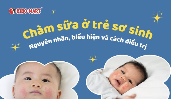 Chàm sữa ở trẻ sơ sinh