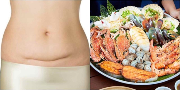 de-mo-bao-lau-an-duoc-hai-san01122025083329 Đẻ mổ bao lâu ăn được hải sản