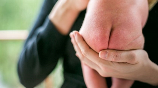 Hướng dẫn sử dụng kem trị hăm cho bé đúng cách