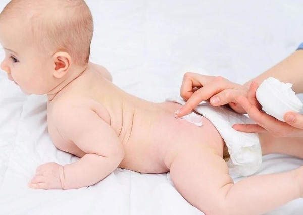 Kem trị hăm giúp làm giảm viêm và làm dịu da bé